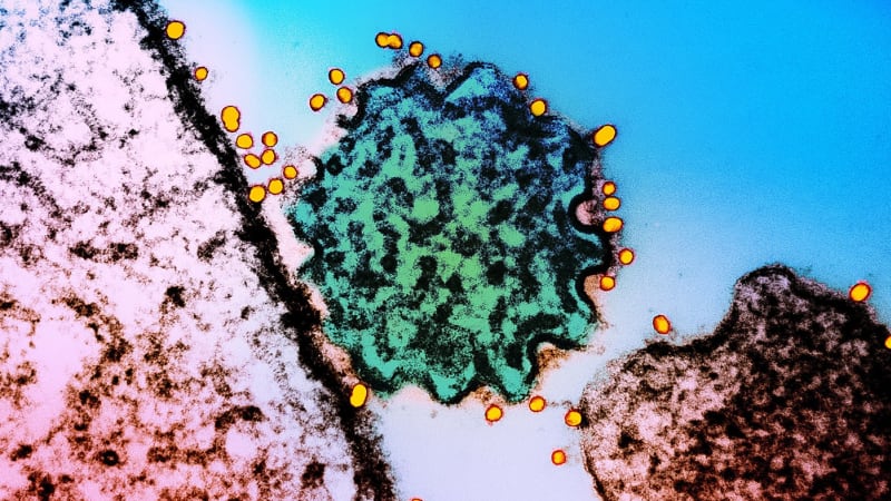 Smrtící virus se šíří Asií, lék neexistuje. Hrozí nákaza přenosem mezi lidmi, varují vědci