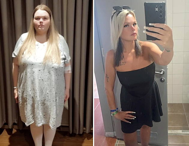 Z morbidně obézní ženy se stala štíhlá kráska. Shodila 70 kilogramů
